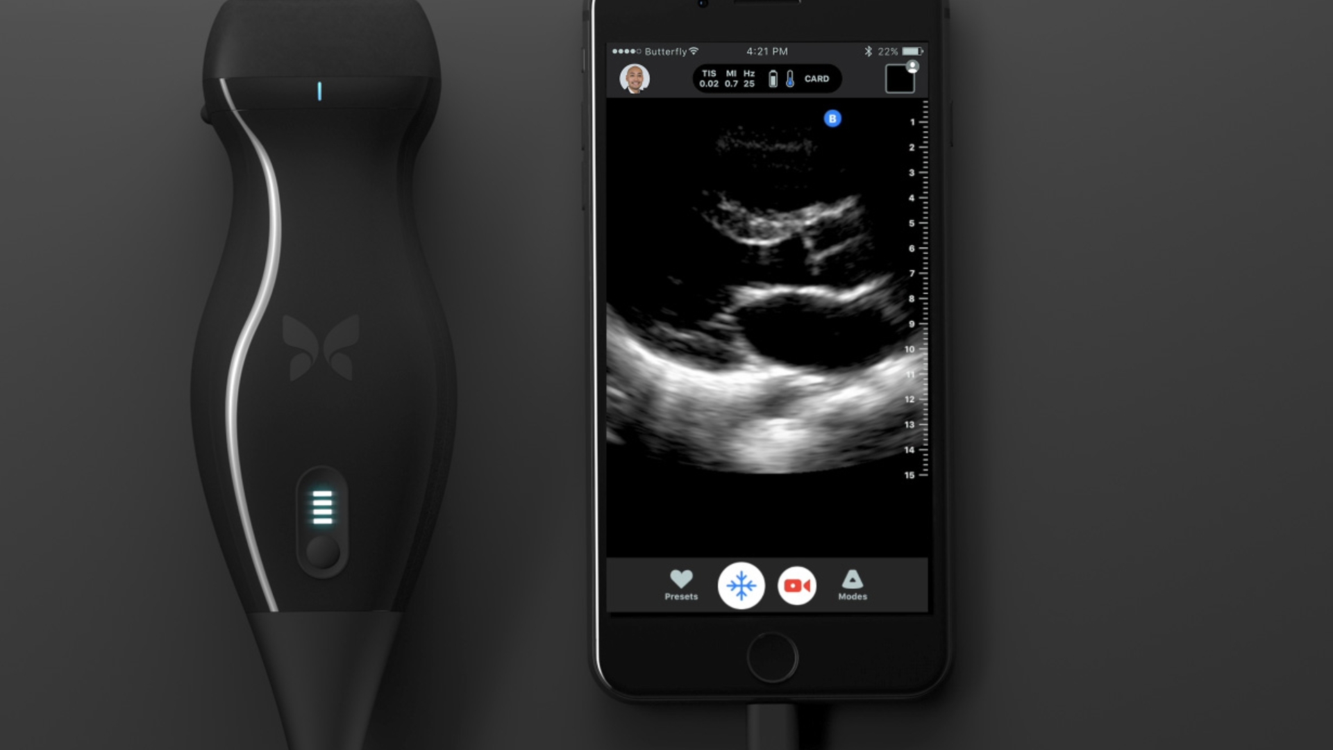 Butterfly-IQ-iPhone Butterfly-IQ-iPhone