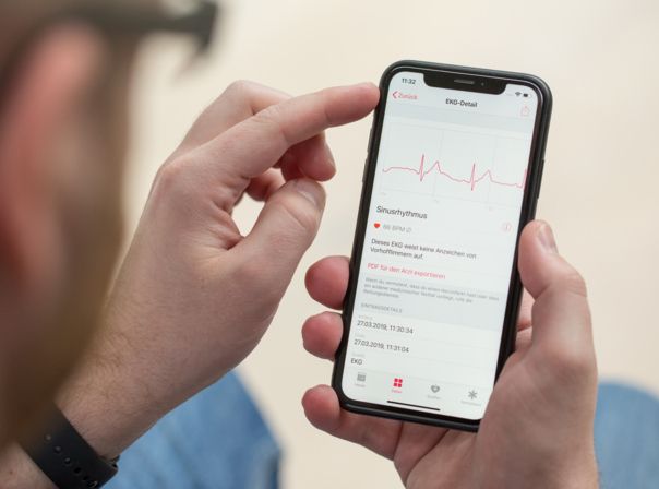 Apple Health soll bald viel fortschrittlicher werden Apple Health
